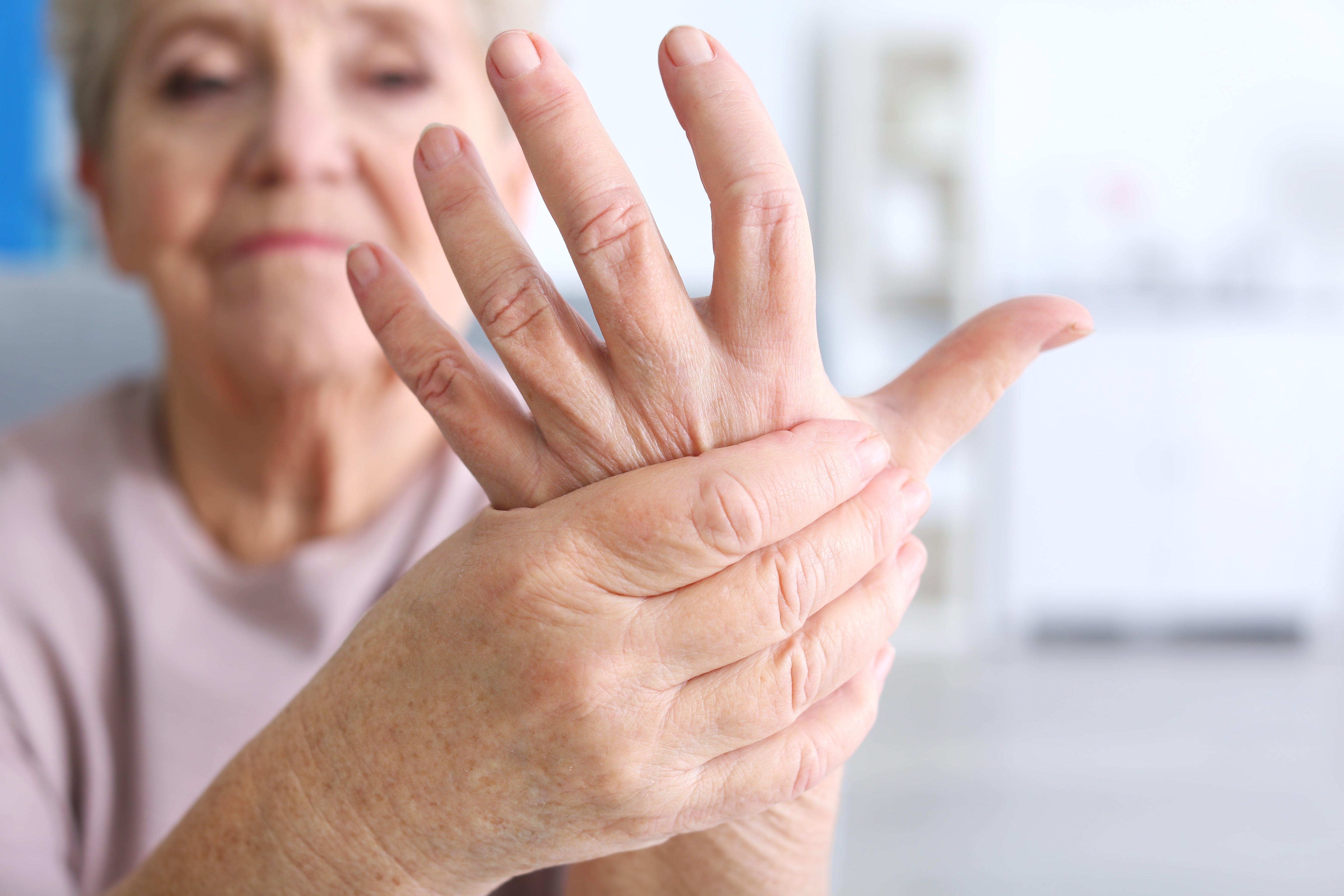 Cómo vivir con artritis reumatoide