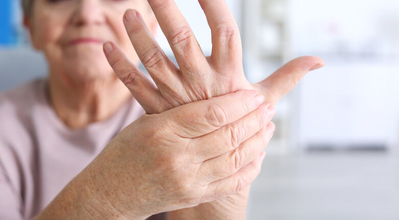Cómo vivir con artritis reumatoide